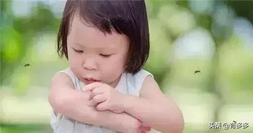 小朋友手受伤了肿的像馒头,孩子手肿得像包子