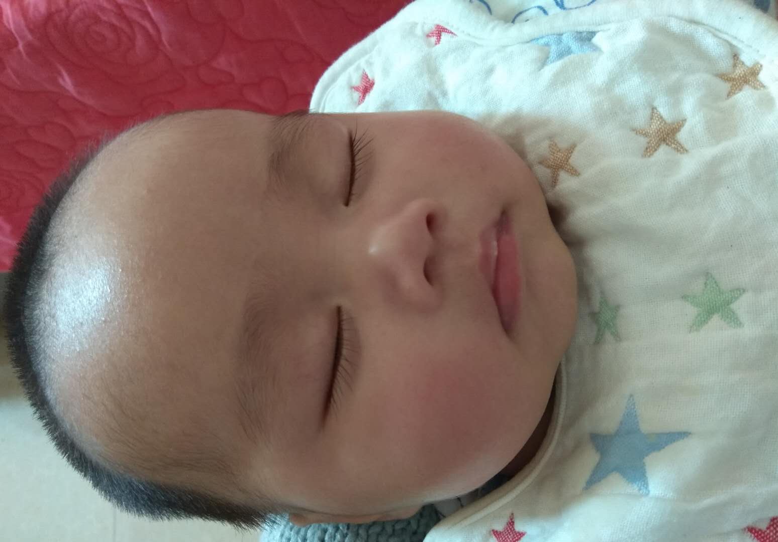 宝宝烂嘴角怎么快速消除,宝宝烂嘴角怎么办最快最有效