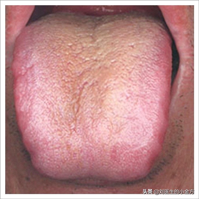 中医舌诊对照表100例,舌诊辨九大体质