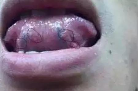 舌头出现信号对身体有什么危险,舌头出现这种症状就要警惕生病了