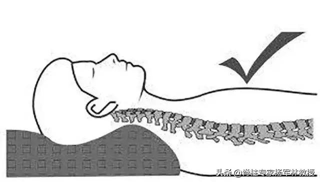 矫正颈椎曲度反弓的方法,小孩颈椎反弓是什么原因