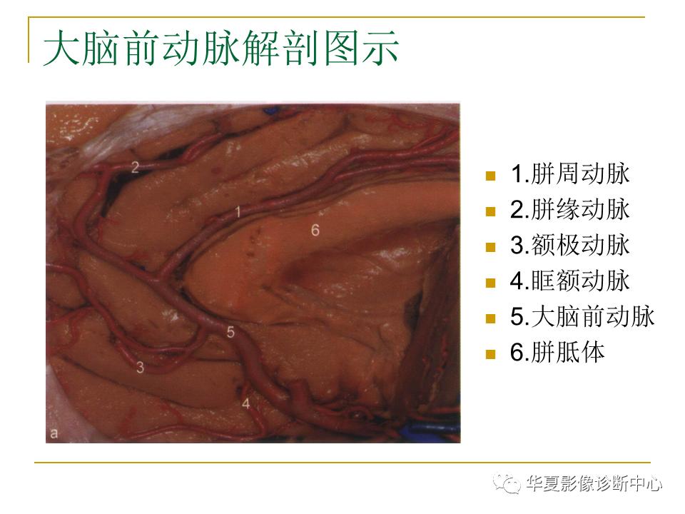 中国人脑立体定向mri应用解剖图谱,脑mri示意图