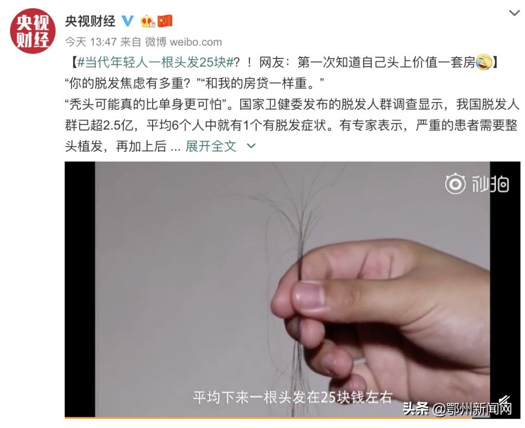 太秃了用什么假发片,秃头怎么办才能防脱发