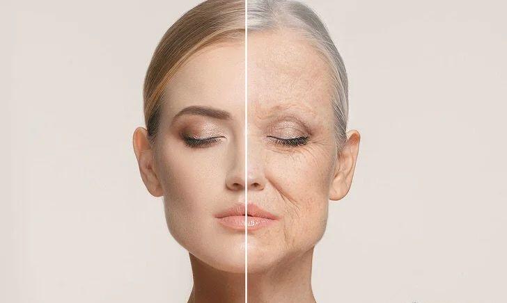 鼻子毛孔粗大怎么缩回去,挤完黑头毛孔粗大能缩回去吗