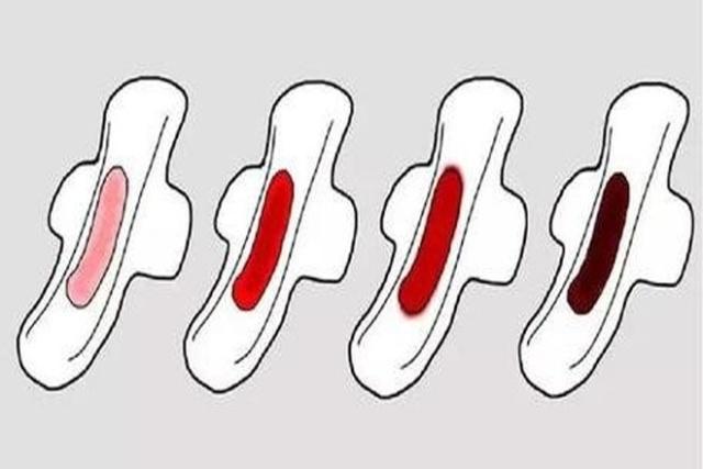 女性月经常见4种颜色,其中有2种颜色属异常,说明子宫有健康问题