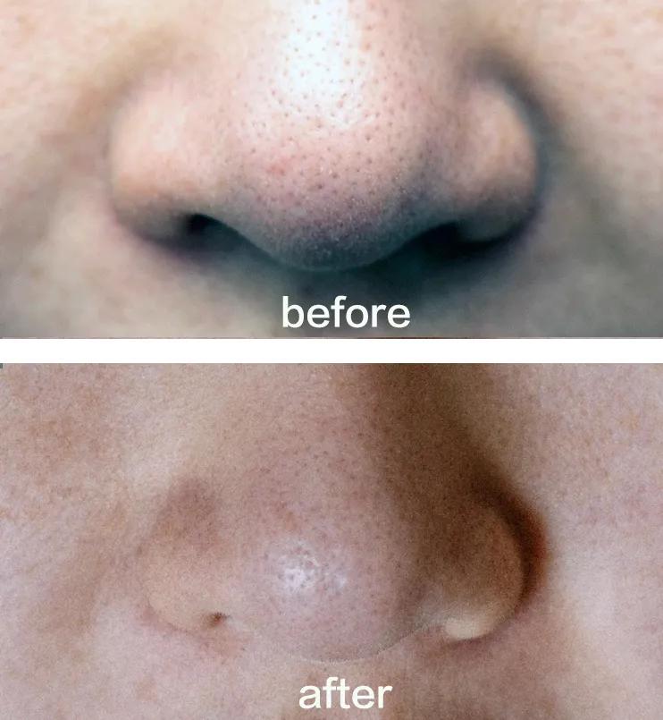 100元美妆面膜推荐,好用的100块面膜