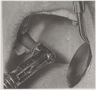 多图直击！牙医如何用抛光把孩子的牙洗干净？#葉子口腔科普#