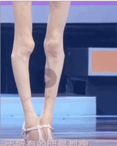 自杀式减肥到58斤:你和ICU,不过一念之隔