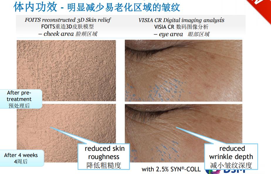 加速女人衰老的5个原因,加快女性衰老的3种原因