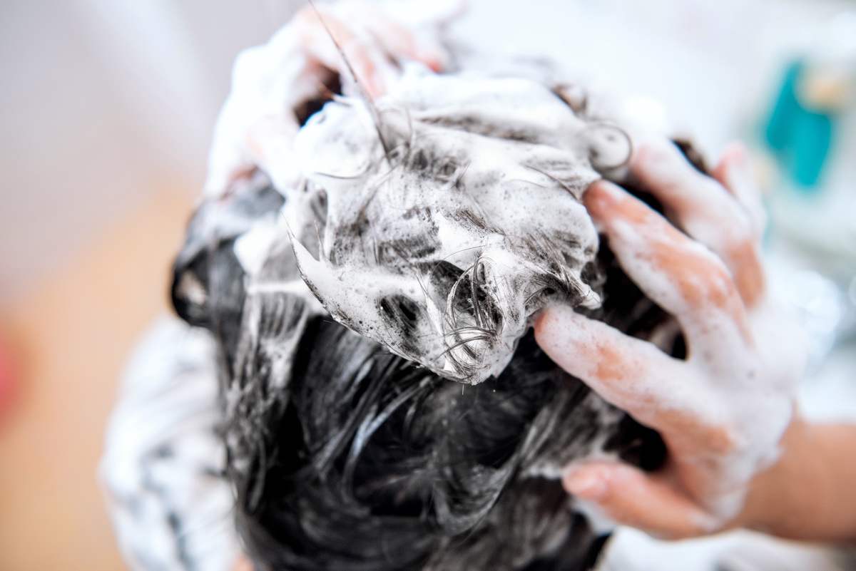 头皮出油屑多怎么去除,头皮痒出油有螨虫怎么解决