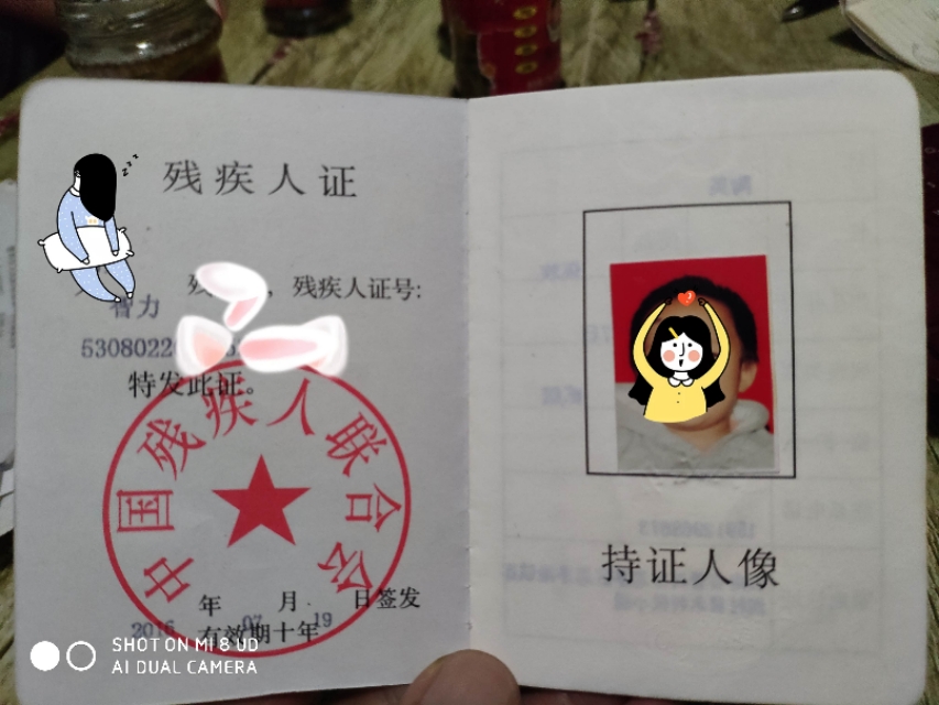 脑瘫儿眼神是什么样的,脑瘫患儿妈妈的心理