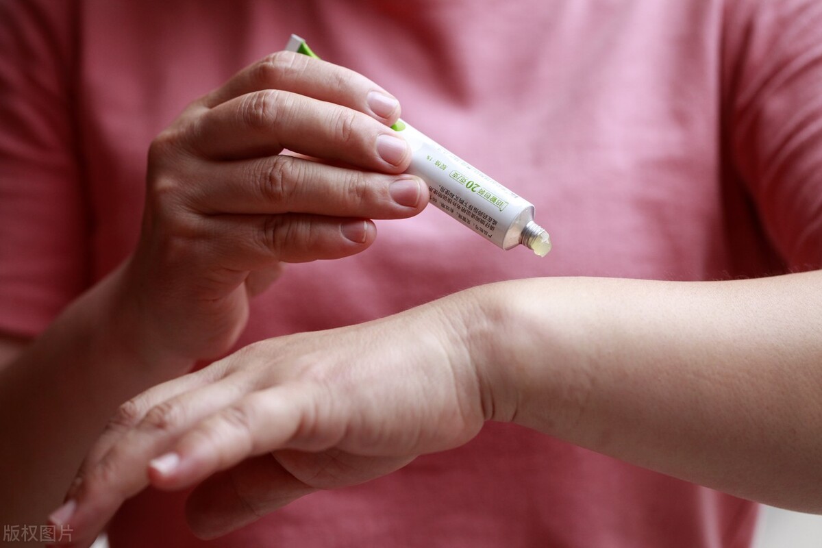 外用药物能治好白癜风么？