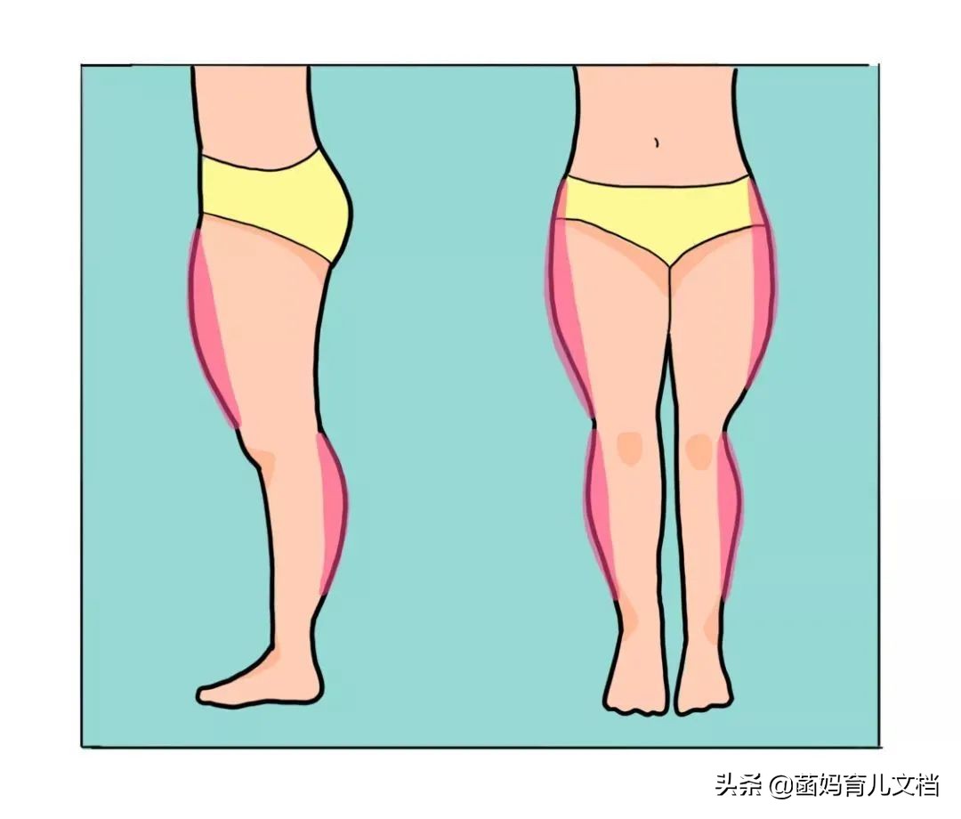 大腿外侧突出、假胯宽、下臀部发达怎么改善？
