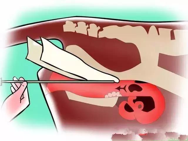 给牛人工授精注意哪些,给牛人工授精教学
