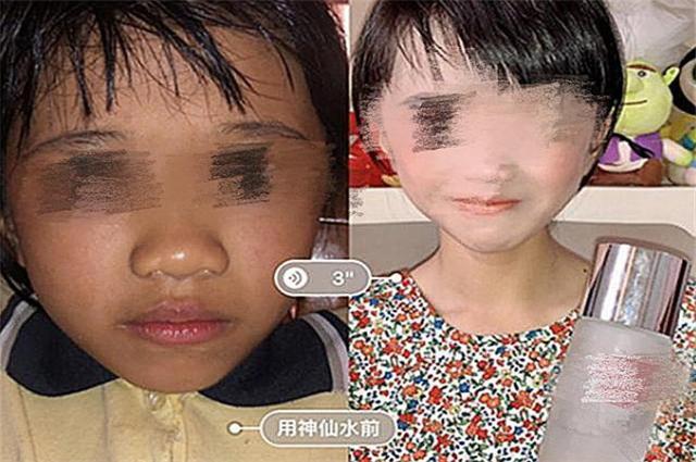 10岁女生用护肤水,女士用神仙水好处