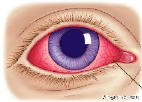 宝宝视力检查异常是什么意思,宝宝眼睛的异常现象