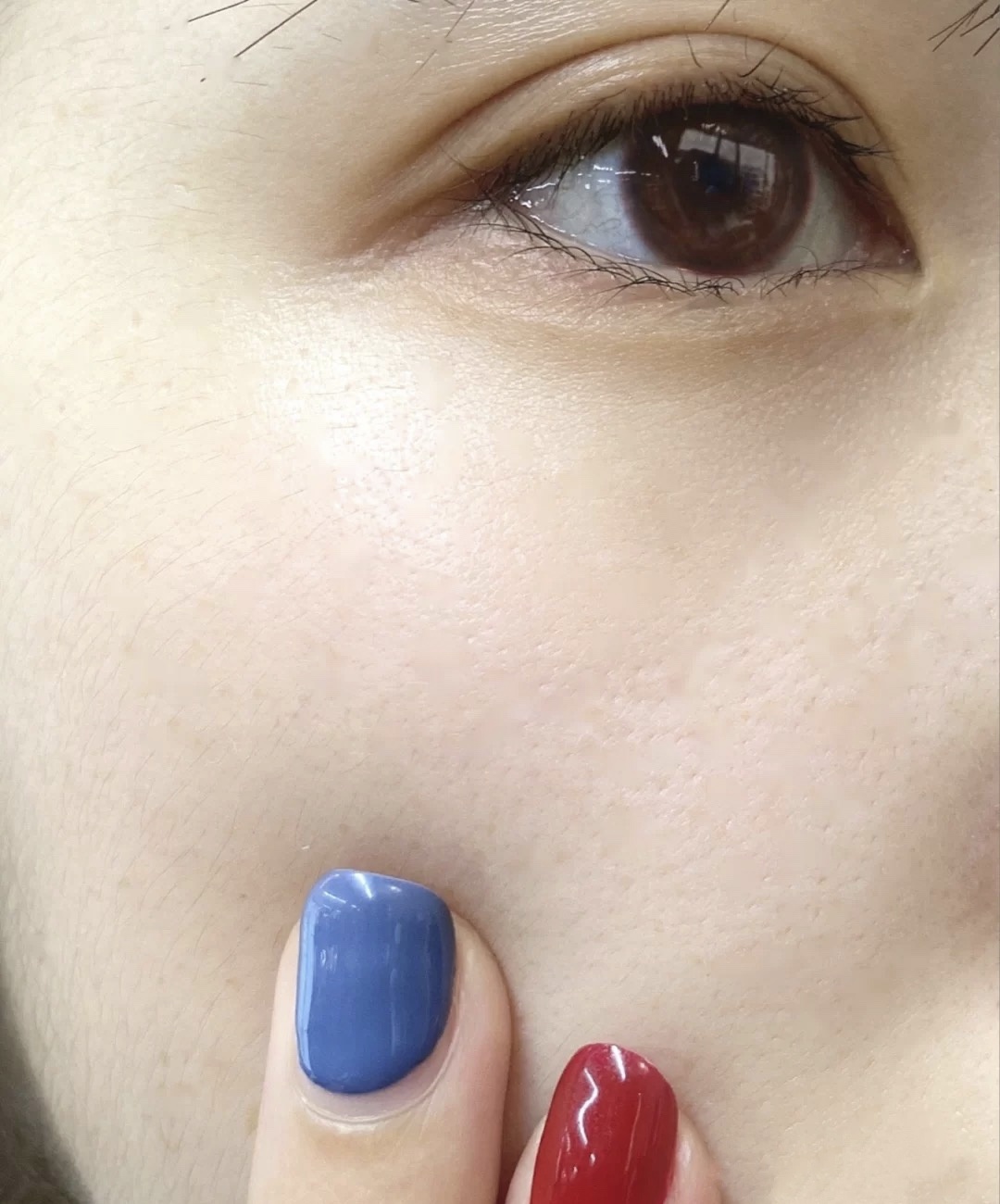 油皮毛孔粗大毛孔多要怎么改善,油皮毛孔粗大护肤品