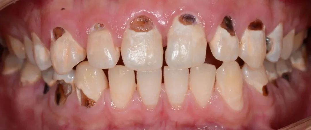 牙医从业感悟,牙医忠告11条