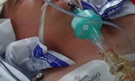 低温治疗的持续时间,低温疗法降温要求