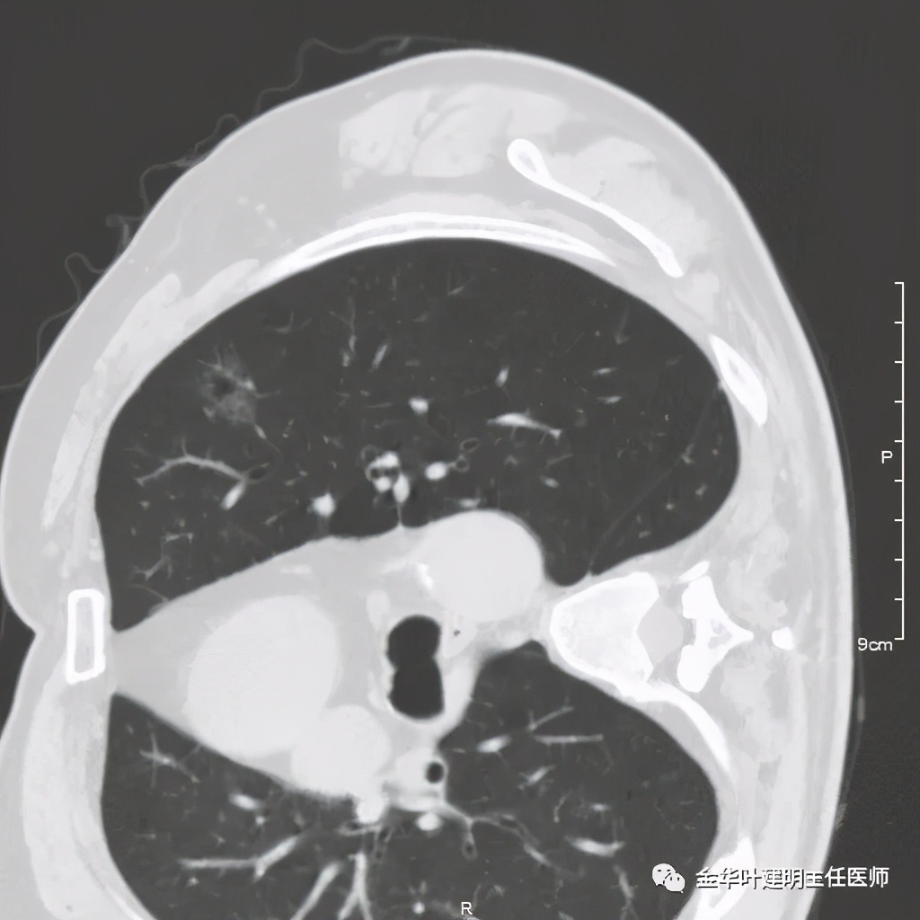 放个大招完整版教学,放个大招完整版前奏