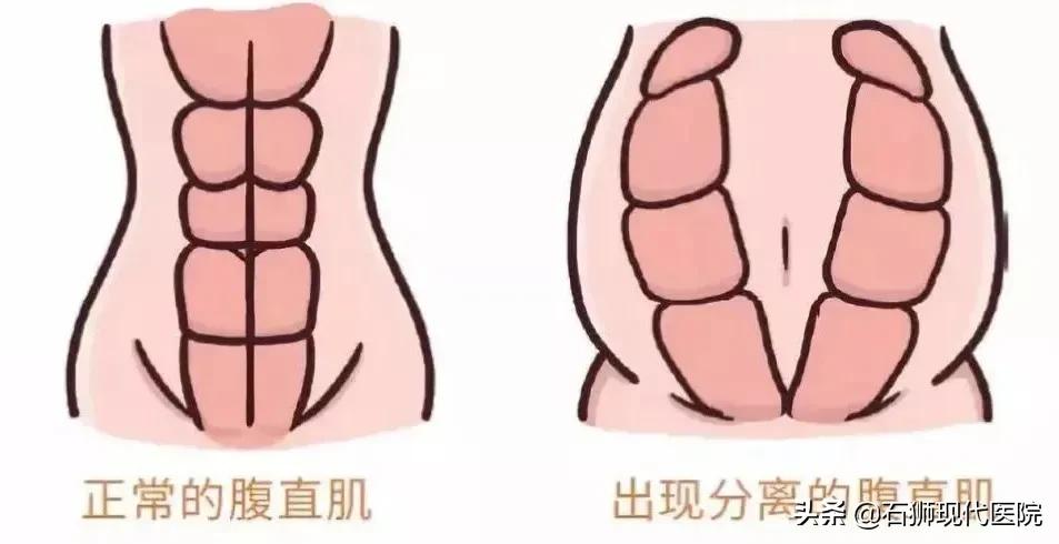 产后恢复宝妈们要重视,产后辣妈的保养方法