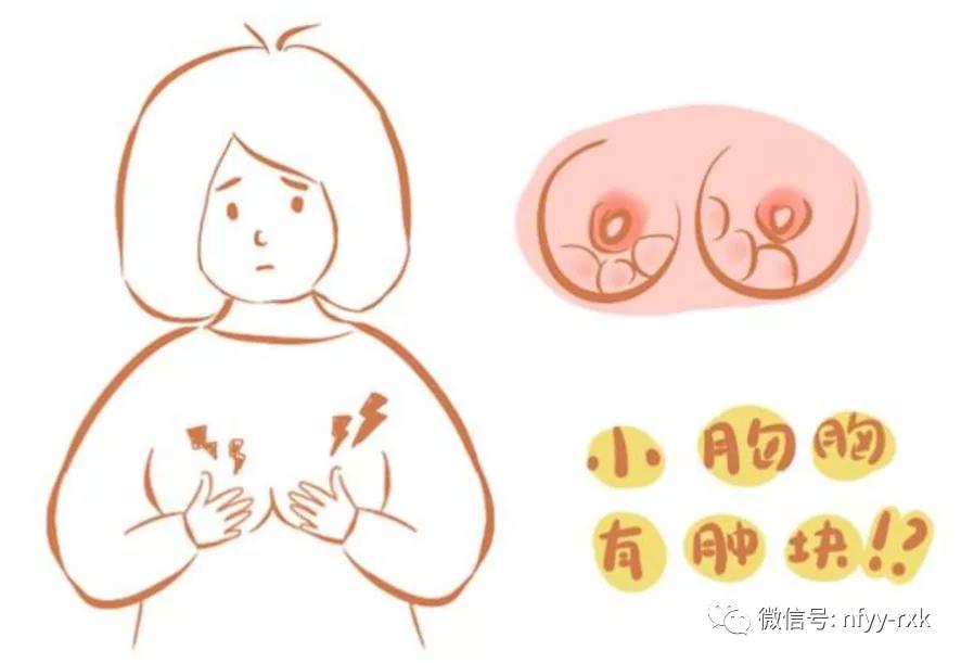 催奶师按摩会把乳腺结节按破吗,乳腺多发性结节可以按摩消除吗