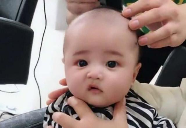 新生儿眉毛乳痂多久好,新生儿乳痂多久可以清理