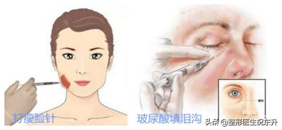 打瘦脸针和玻尿酸哪个伤害大,玻尿酸和瘦脸针打多了有啥坏处