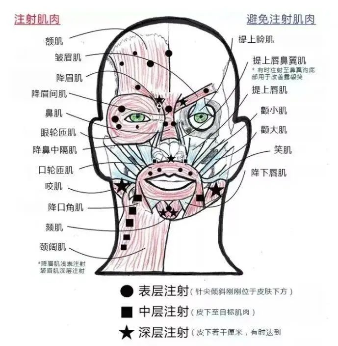 打瘦脸后脸僵硬怎么恢复快,打瘦脸笑不出来面部僵硬怎么恢复