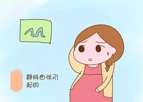 预防静脉曲张八点注意事项,预防静脉曲张的几个动作