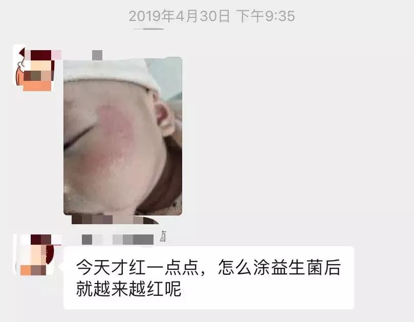 我潜入益生菌微商群1周,发现了包治百病的秘方