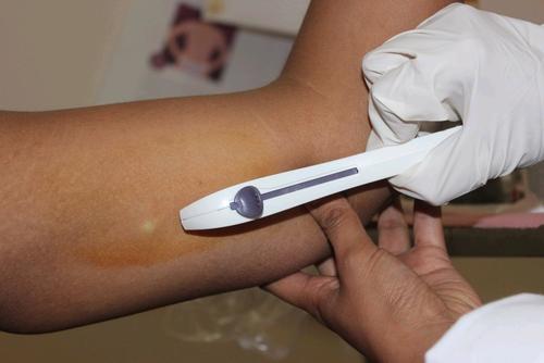 取环以后有什么避孕措施和办法,节育环是怎样实现避孕的