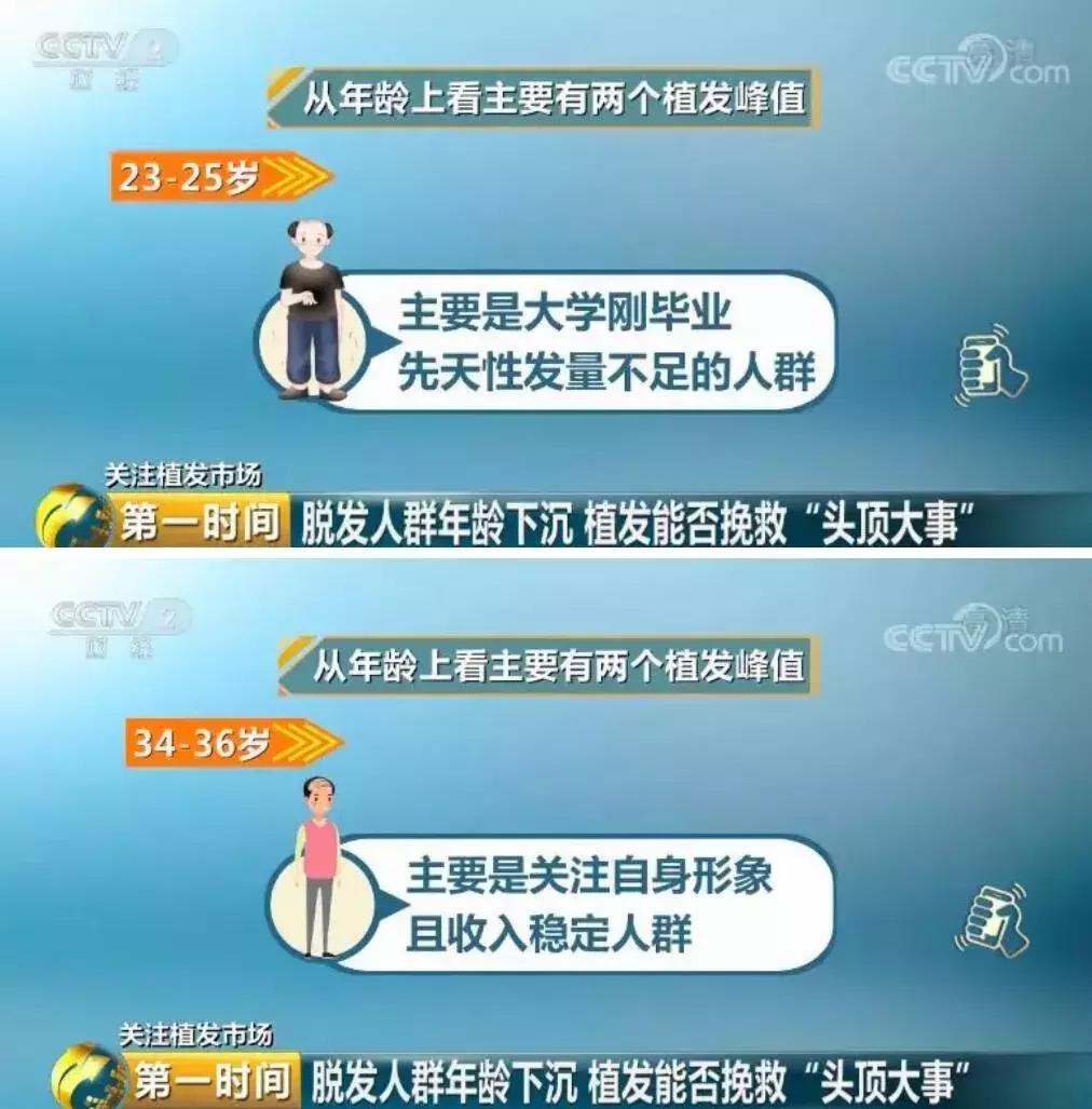 秃如其来视频完整版,秃如其来为哪般