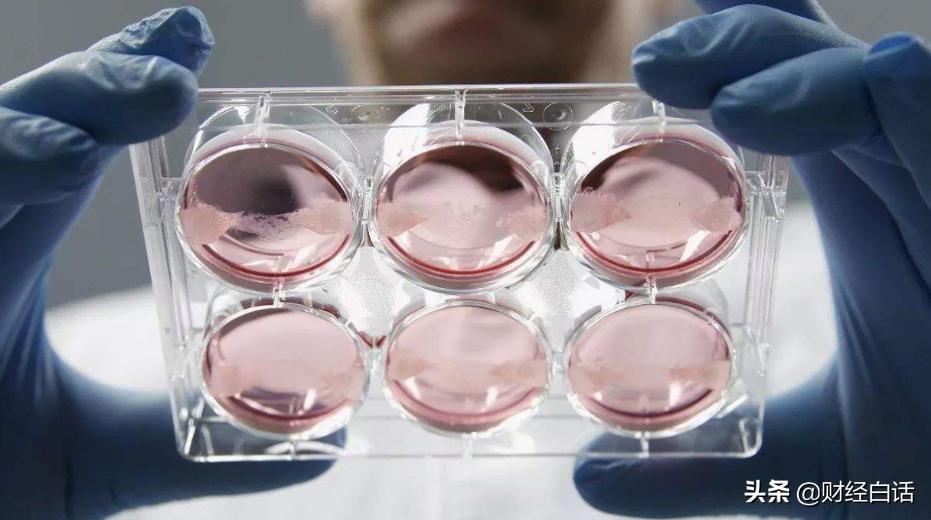 对抗秃头“钱景”大：富豪花30万植发，巨头力捧“生发药”