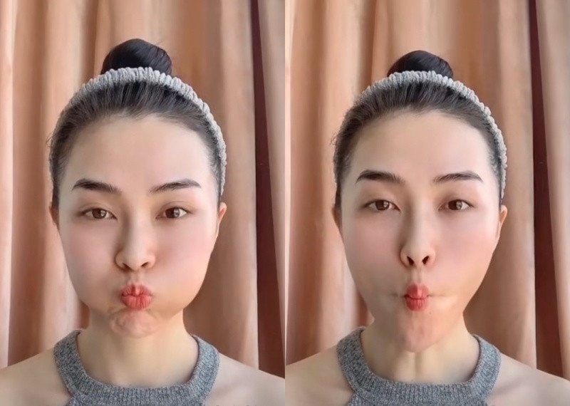 笑起来有法令纹按摩,大笑造成的法令纹可以按摩消除吗