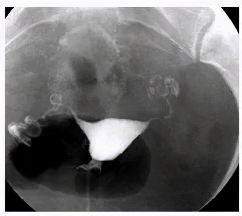 科普知识马桶,马桶管道科普