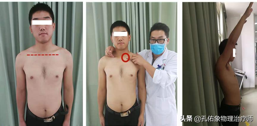 左手麻肩胛骨疼痛是怎么回事,手麻肩胛骨痛