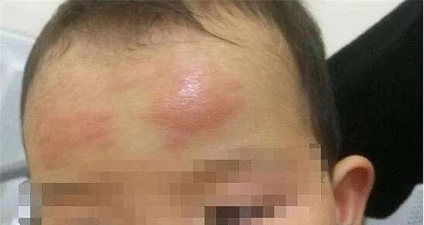 多少家长被退热贴骗了,退热贴真的没用吗