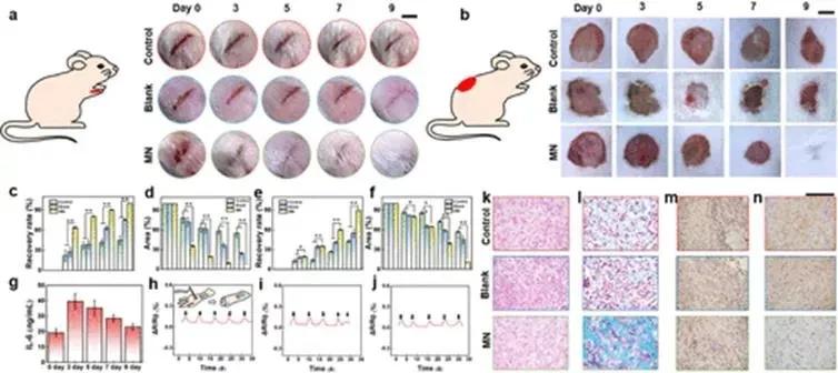 南京工业大学:一种可实现伤口智能管理的微针敷料