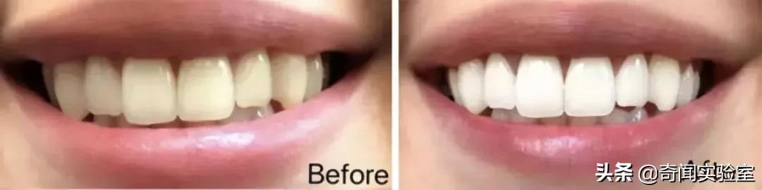 专治牙黄口臭的小窍门,牙黄口臭用什么牌子牙膏刷牙最好