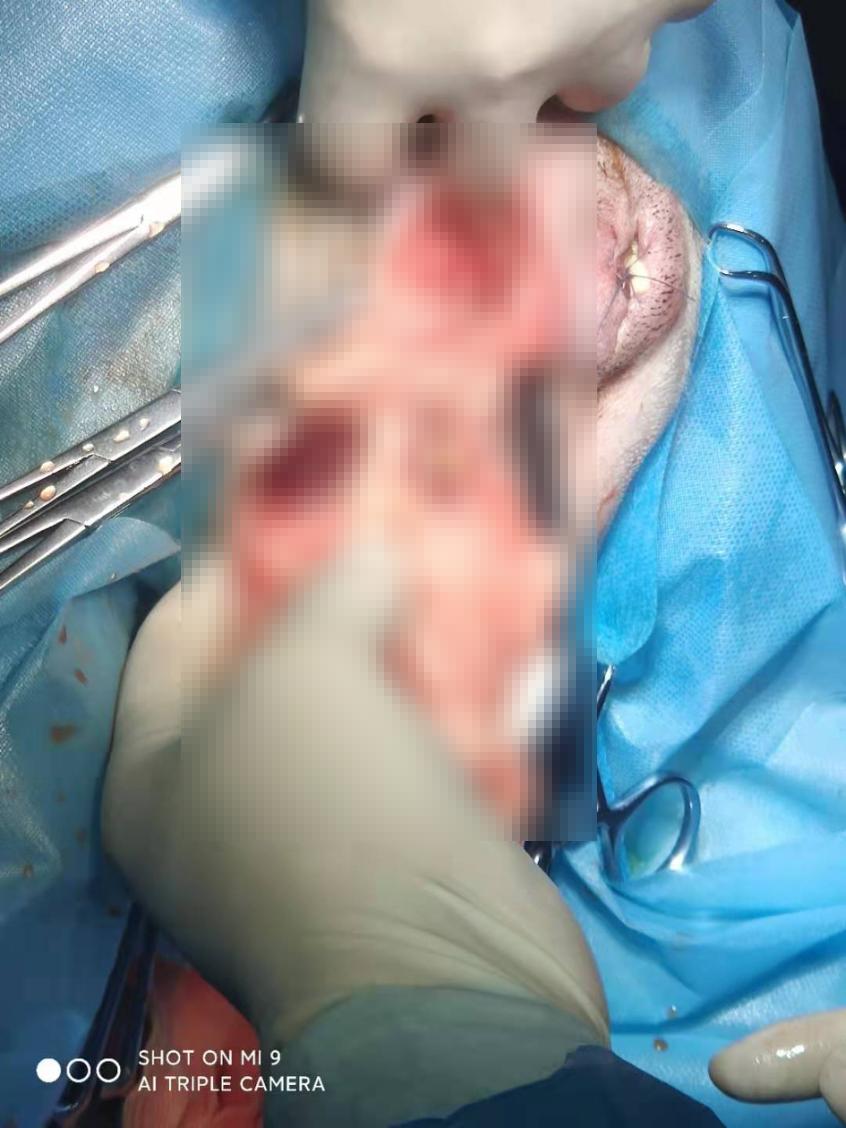 狗狗肚脐鼓包长大后能自愈吗,狗会阴疝复发咋办