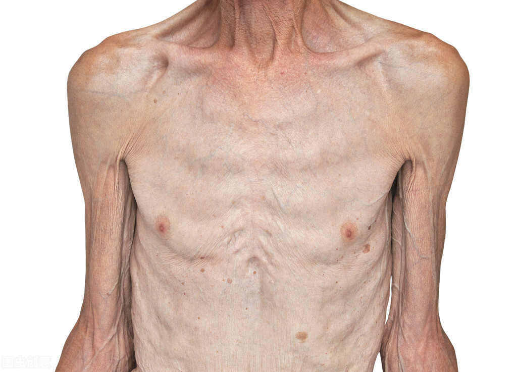 两年前就被查出肝癌晚期,37岁小伙查出晚期肝癌