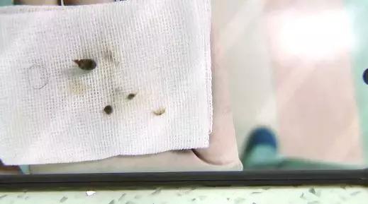 女孩肚子痛还流血，隔了几天走路都不对劲了！