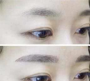 刚做完眉毛有点红,刚做完眉毛浓粗正常吗