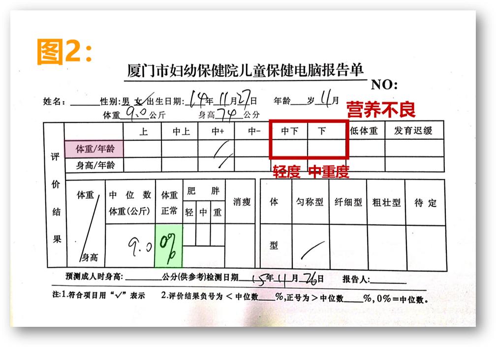 儿童怎么测偏胖偏矮,孩子体检结果轻度消瘦