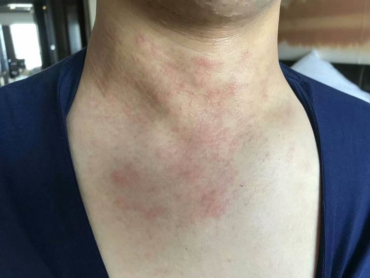 援鄂抗疫,援鄂抗击疫情英雄归来