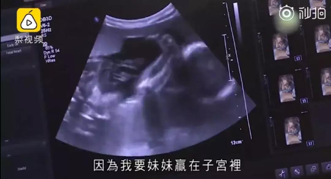 拼子宫,拼铂金包,拼头等舱……焦虑的母亲们真是屡屡拼出新高度