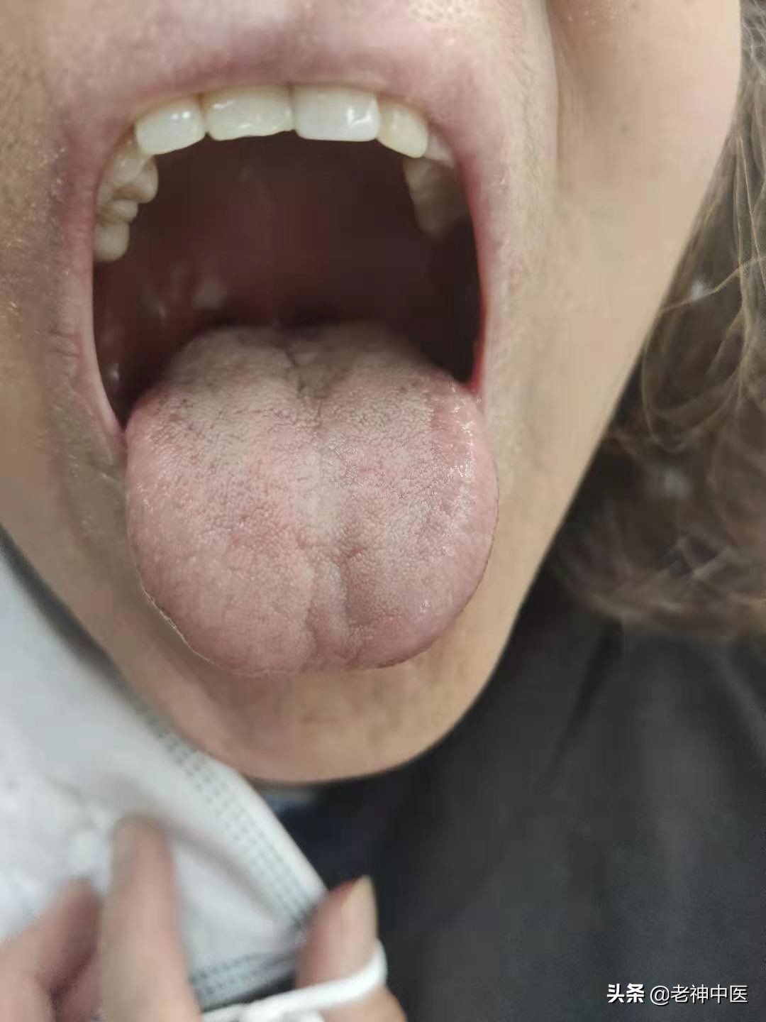 冠心病胸绞痛,冠心病肩背疼吃什么药