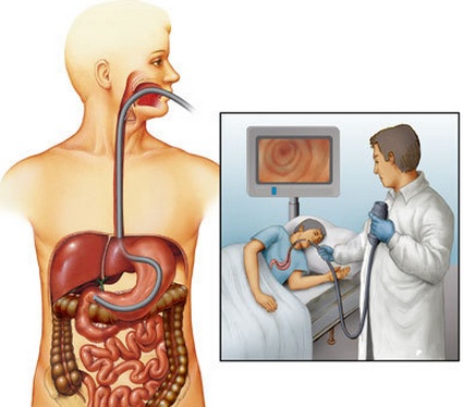 胃病严重了是啥后果,严重胃病会有哪些症状