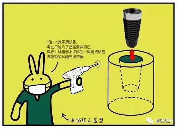 种植牙图片漫画,3d动画2分钟全面了解种植牙全过程